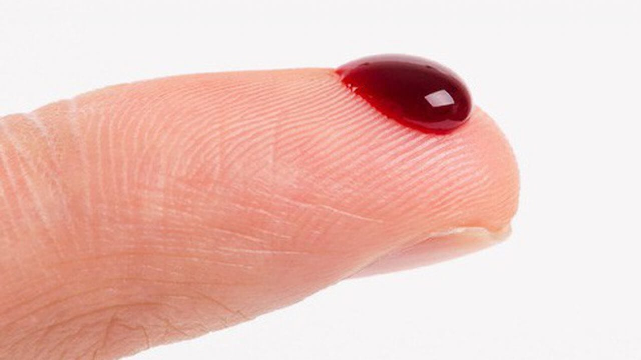 Ý nghĩa chung của giấc mơ thấy máu